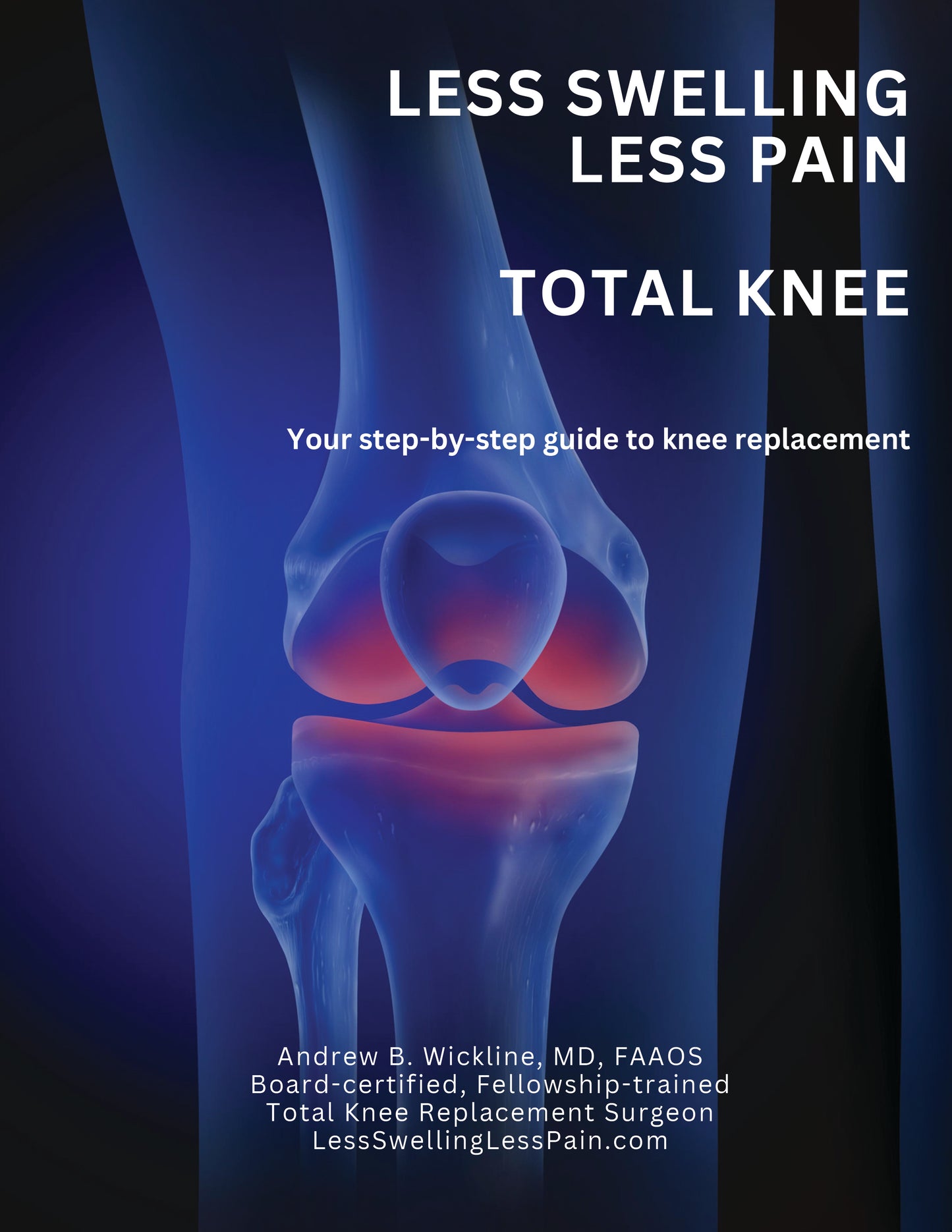 TOTAL KNEE - LESS SWELLING  LESS PAIN