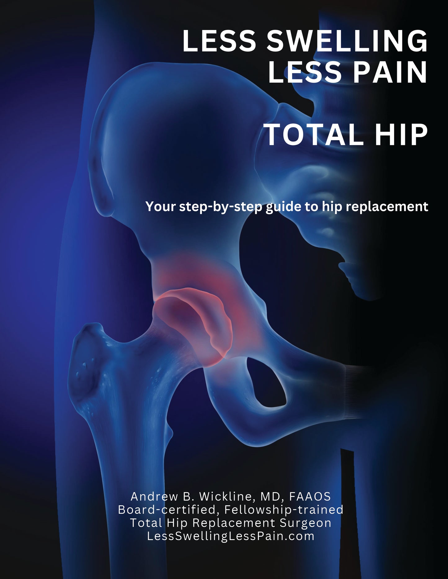 TOTAL HIP - LESS SWELLING  LESS PAIN