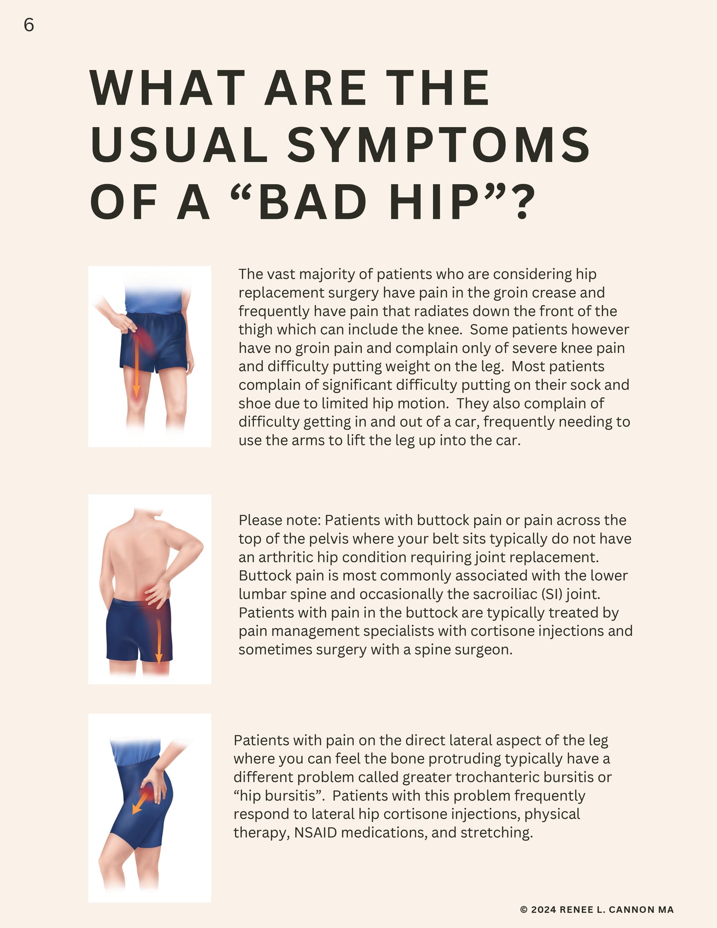 TOTAL HIP - LESS SWELLING  LESS PAIN